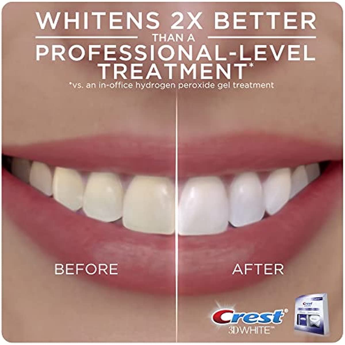 Crest 3D Whitestrips with Light, Teeth Whitening Strip Kit, 20 Strips (10 Count Pack)