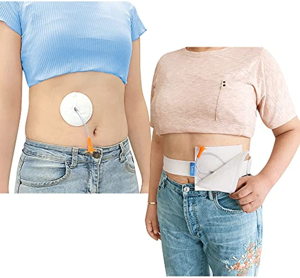 Gtube Button Covers (12 Pcs) and Feeding Tube Belt (1 Pcs) Supplies Peritoneal Dialysis Accessories G Tube Pads Pd Peg Tube Holder Ostomy Accessories