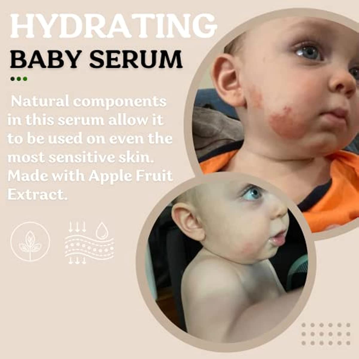 Roe Wellness Baby Children\'s Serum | All Natural Hydrating Serum For Baby Acne, Dry Skin, Moisturizing with Apple Fruit Extract, and Daily Probiotics Soothing & Anti-Inflammatory