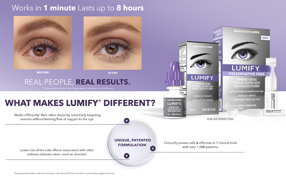 redness relief, dry eye