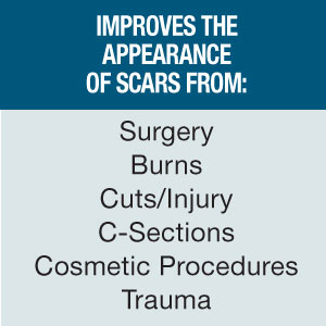 Scar Gel Small Image