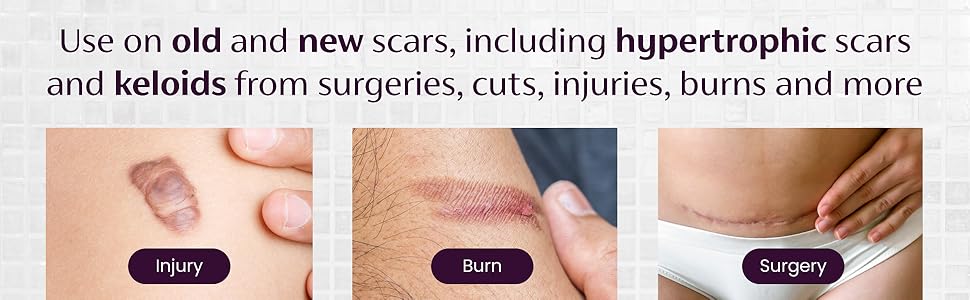 Old and new scars