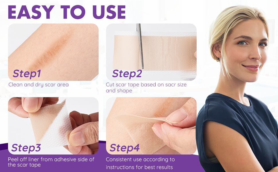silicone tape for scars