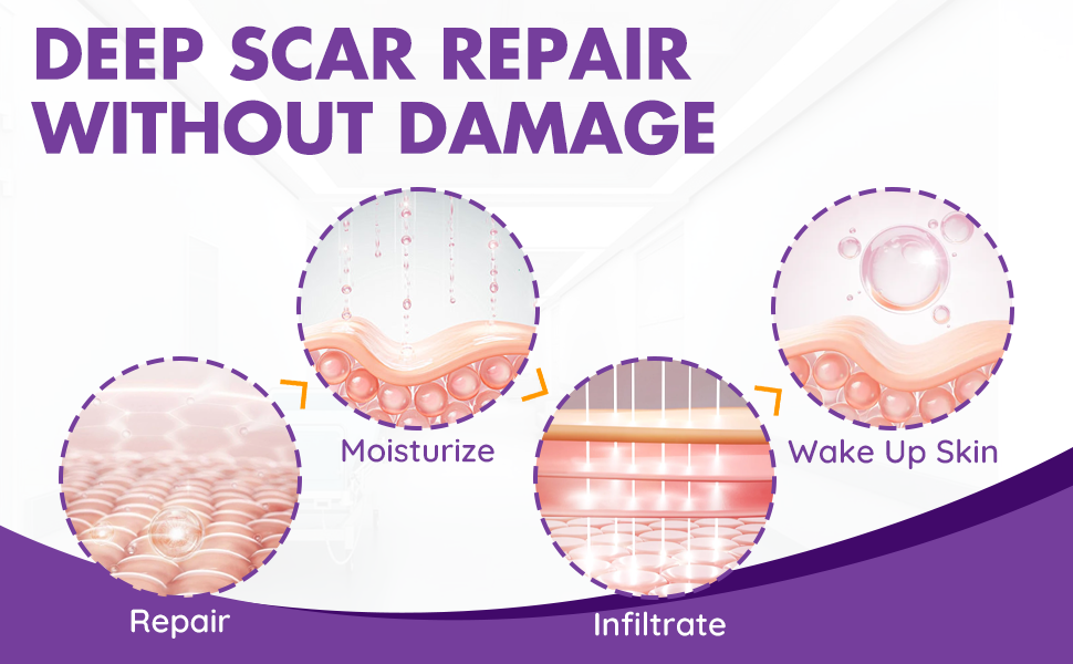silicone scar sheet