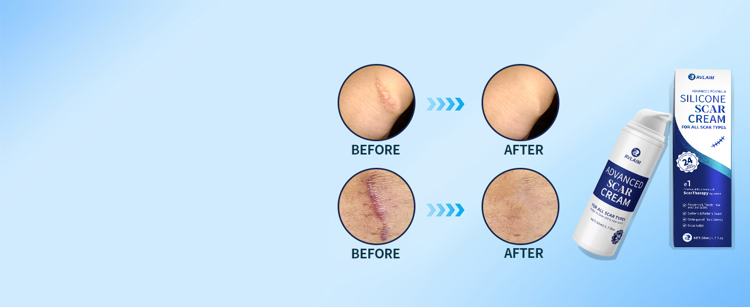 Return skin to a smooth and supple state