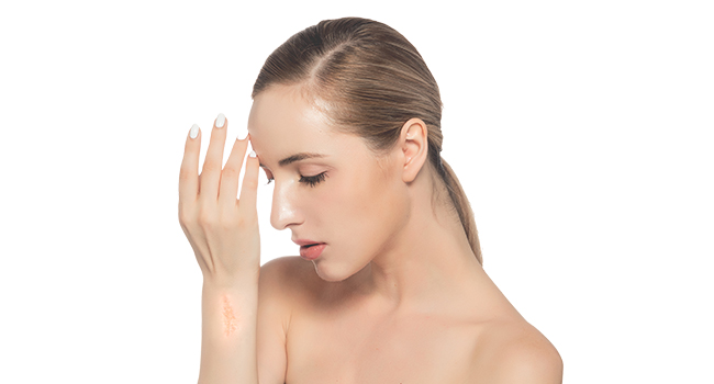 Why Choose Advanced Scar Cream