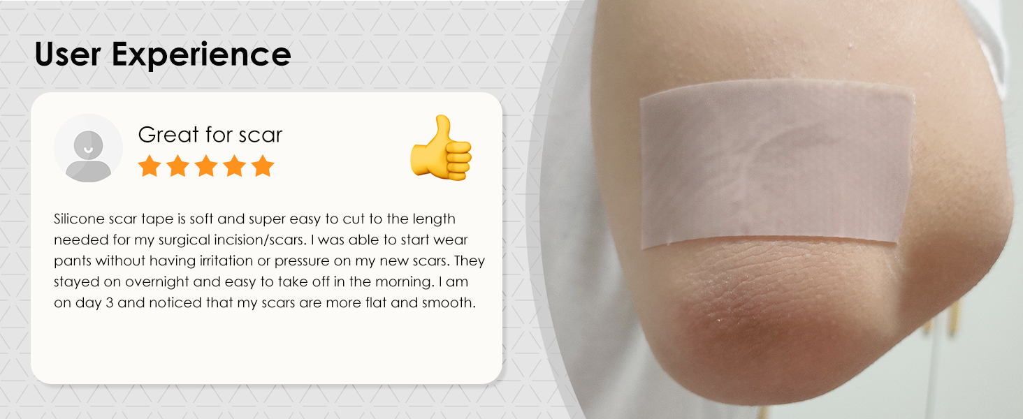 silicone scar sheets