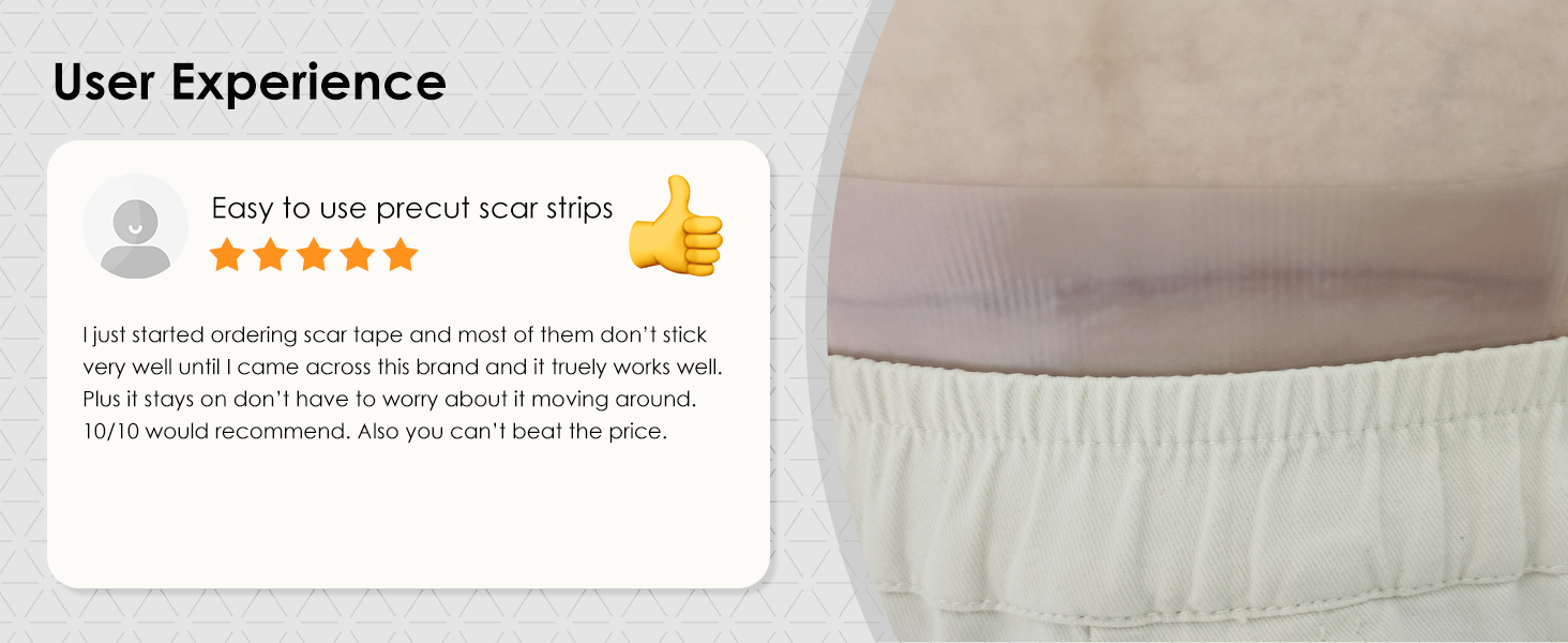 silicone scar sheets