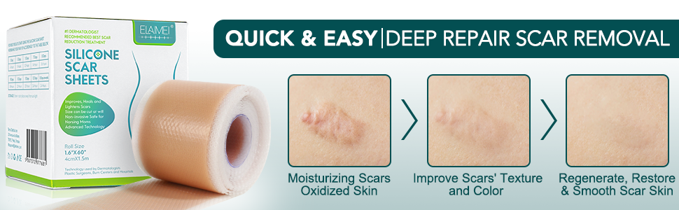 Silicone Scar Sheets