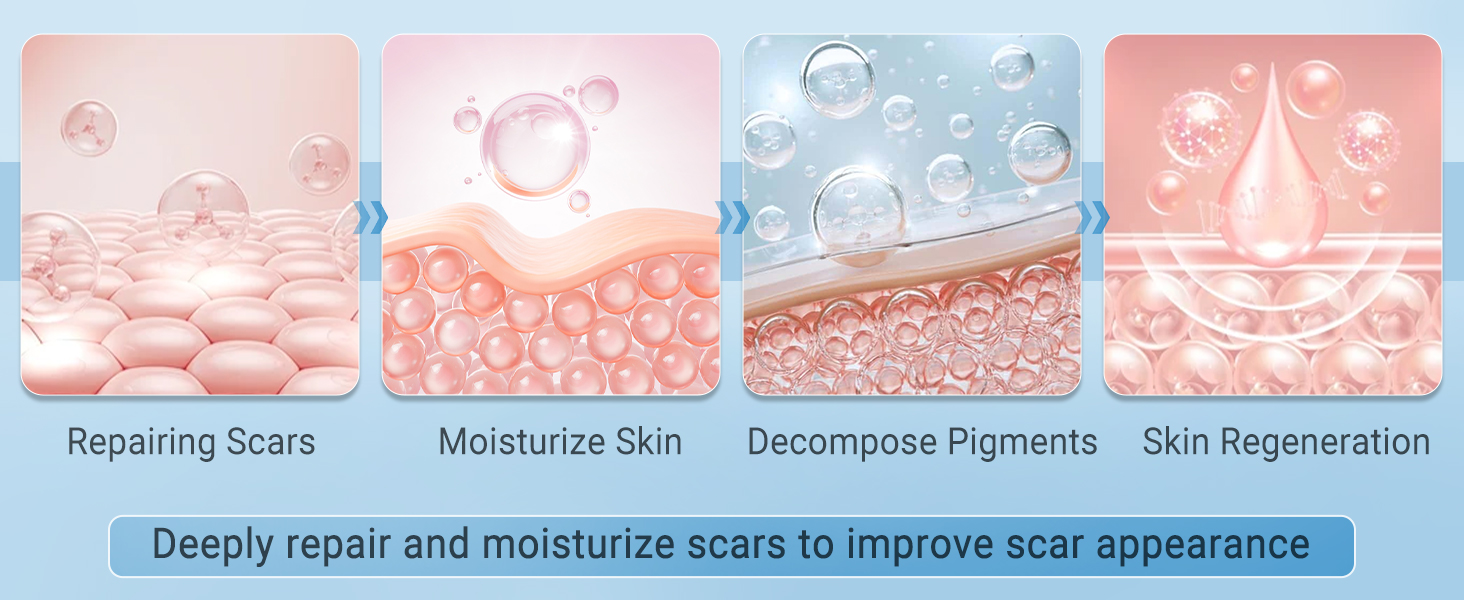 silicone scar gel feature