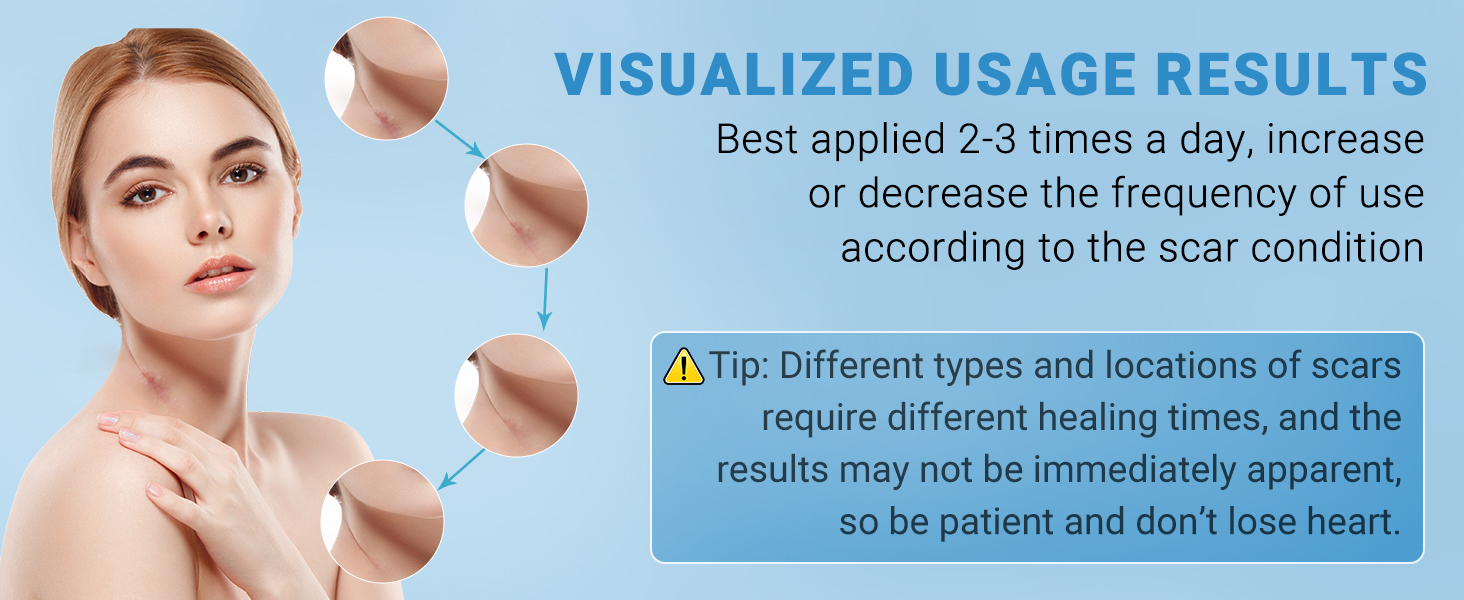 scar gel effectiveness