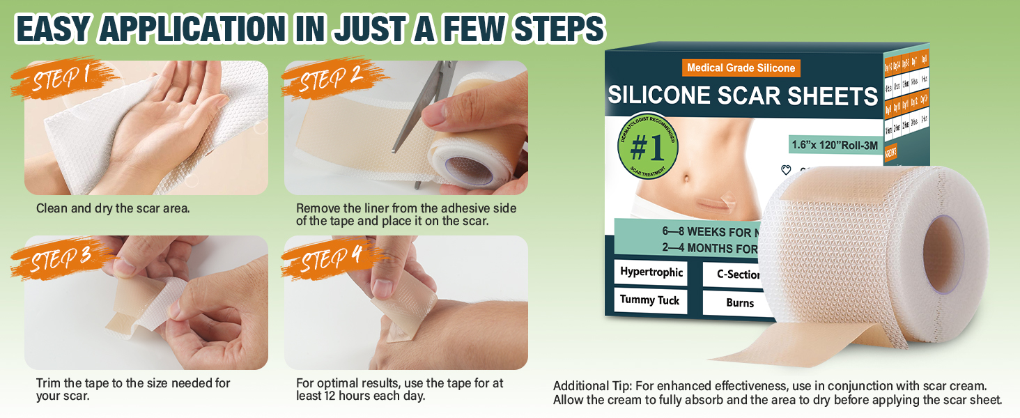 silicone scar sheets